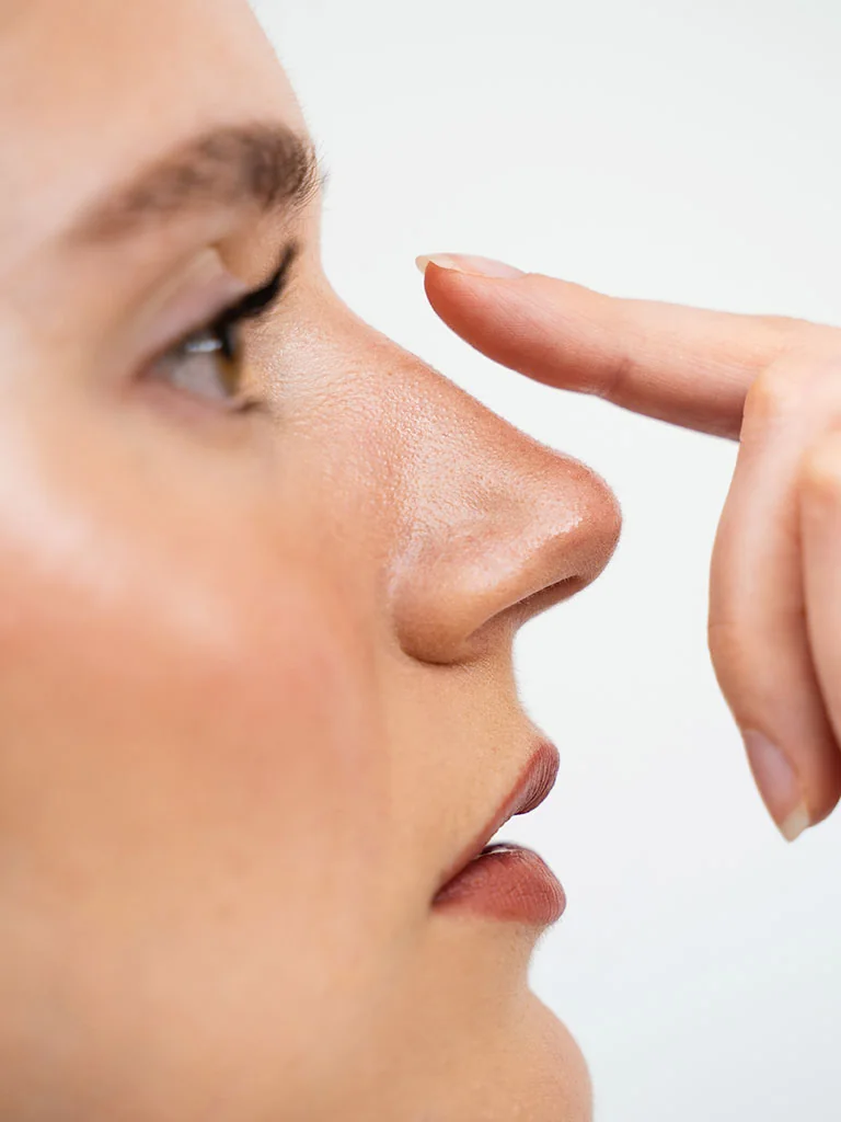 Rinoplastia - planejamento estético nasal com naturalidade.