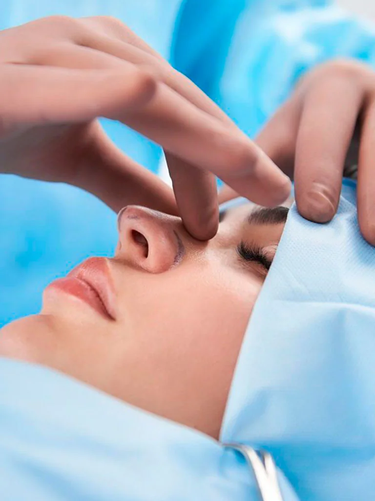 Rinoplastia estético-funcional e avaliação respiratória.